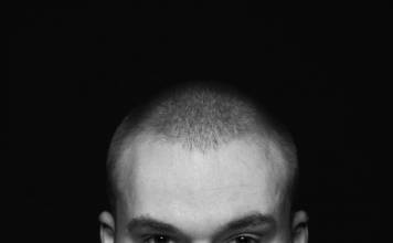 Na co zwracać uwagę przed i po przeszczepie włosów – zalecenia od specjalisty Na co zwracać uwagę przed i po przeszczepie włosów